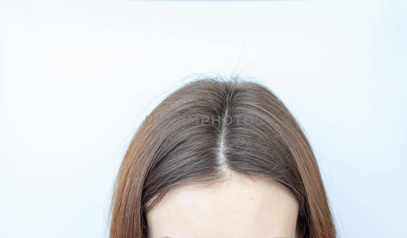 A woman's head with a parting of gray hair.  by AnatoliiFoto