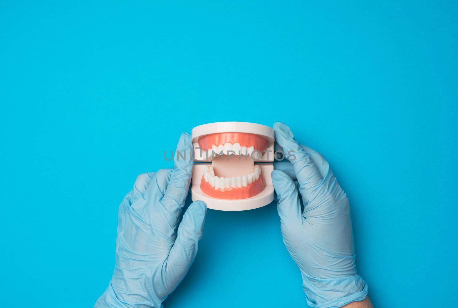 female hand in blue latex gloves holds plastic model of a human jaw with white teeth on a blue background, oral hygiene