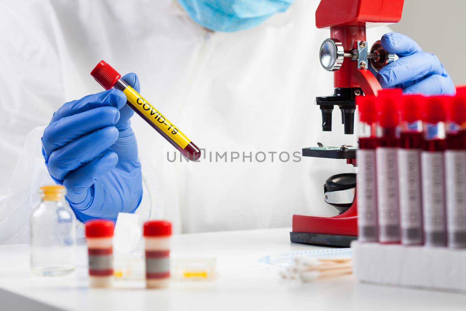Lab technician holding test tube with label COVID-19,microscope analysis of recovered Coronavirus patient blood specimen sample,antibody convalescent platelet rich plasma serum therapy,immune system