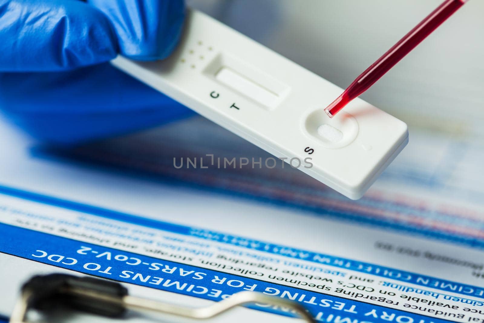 Medical laboratory technician placing blood sample specimen on quick rapid diagnostic test using pipette by Plyushkin