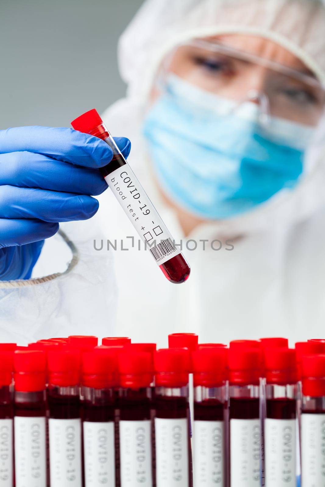 Lab technician or medical scientist wearing protective suit,face maks and goggles, holding COVID-19 patient blood sample container,serological testing procedure,detection of antibodies and immunity