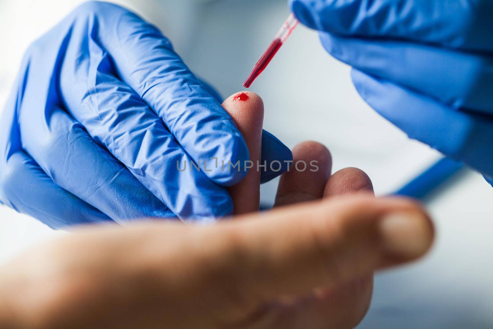 Medical technician EMS doctor taking finger prick PRP patient blood sample using pipette by Plyushkin