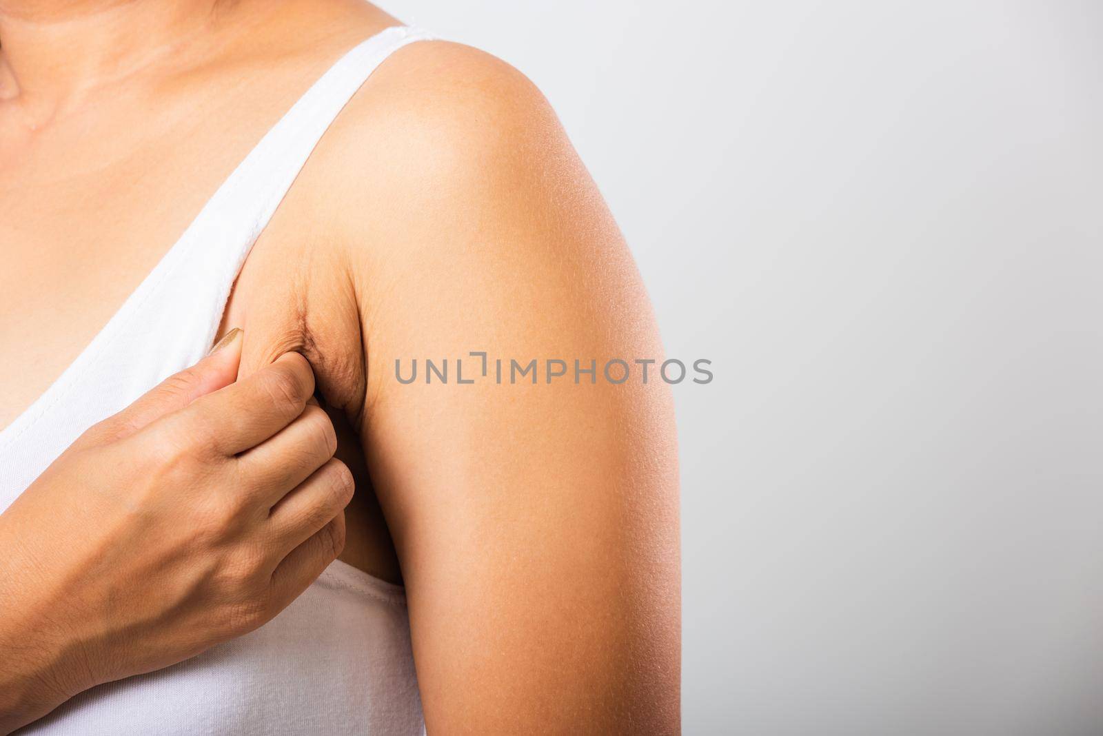 Close up of Asian woman pulling excess fat on her skin underarm she problem armpit fat underarm wrinkled skin, studio isolated on white background, Healthy overweight excess body concept