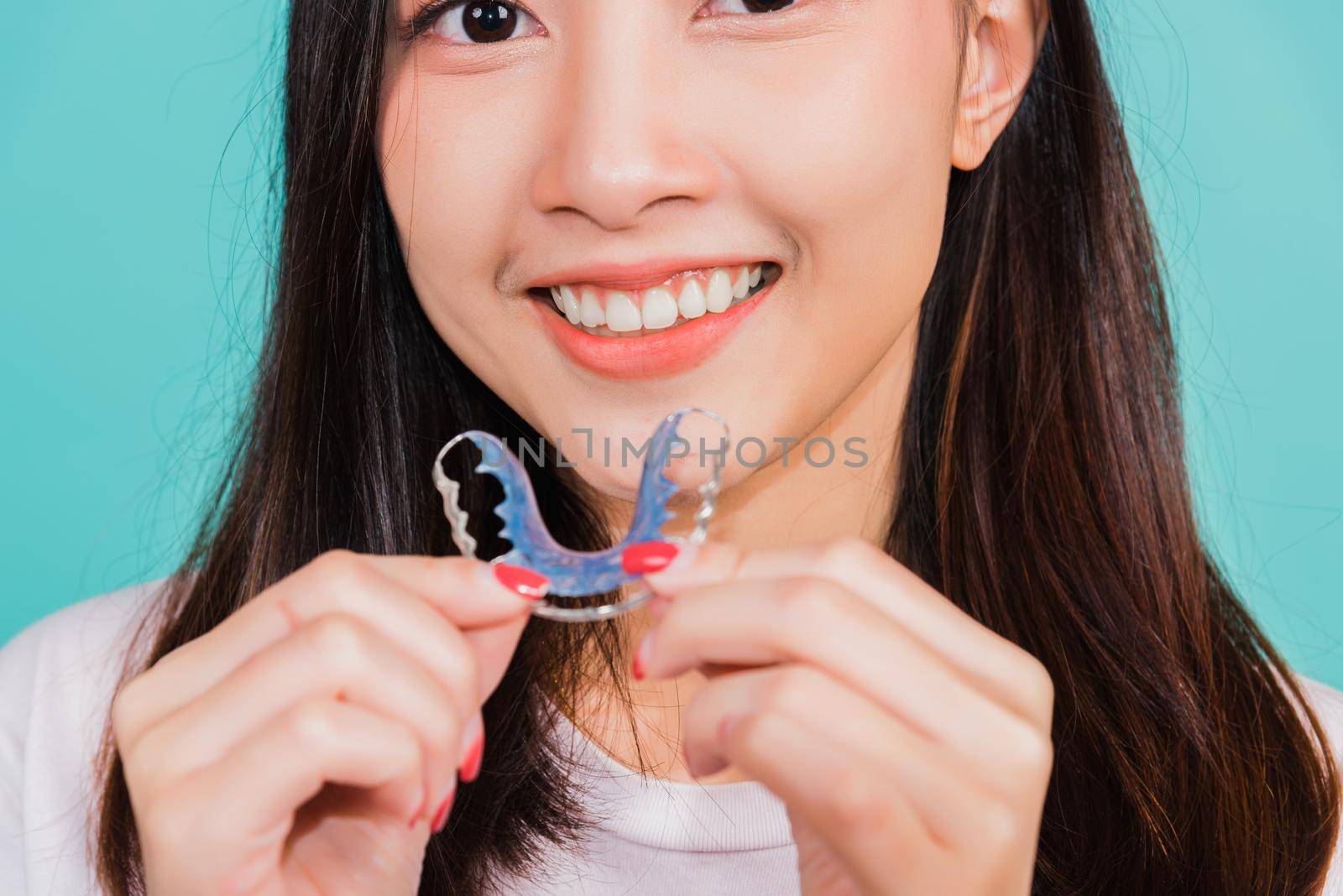 Teeth retaining tools after removable braces by Sorapop