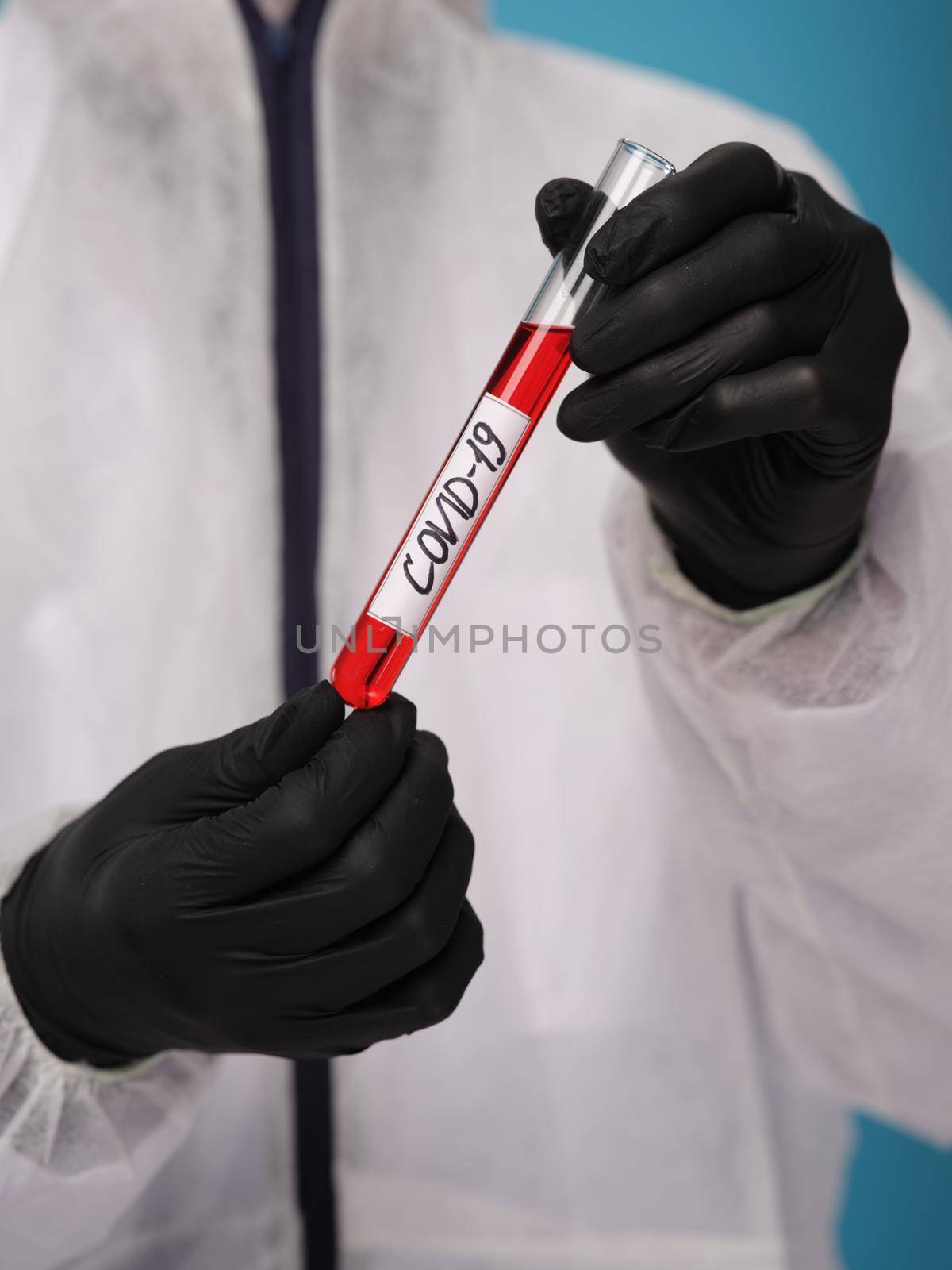 Laboratory blood test black gloves research diagnostics by SHOTPRIME