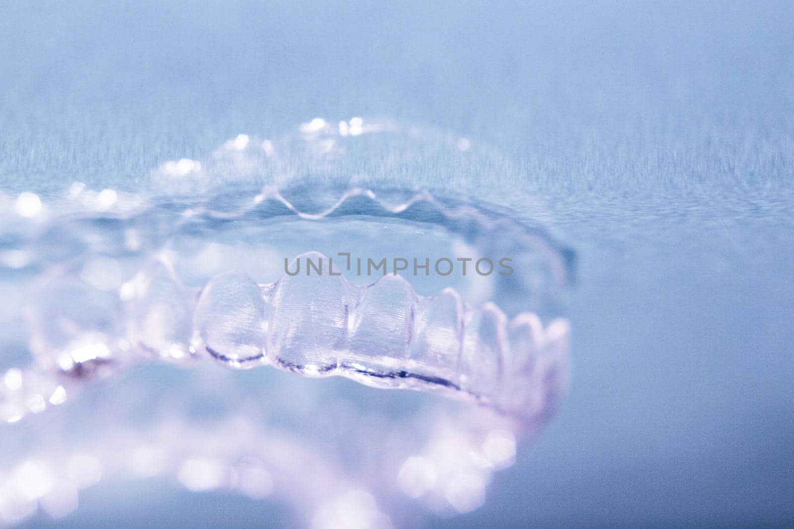 Retainer splint and transparent teeth corrector by GemaIbarra