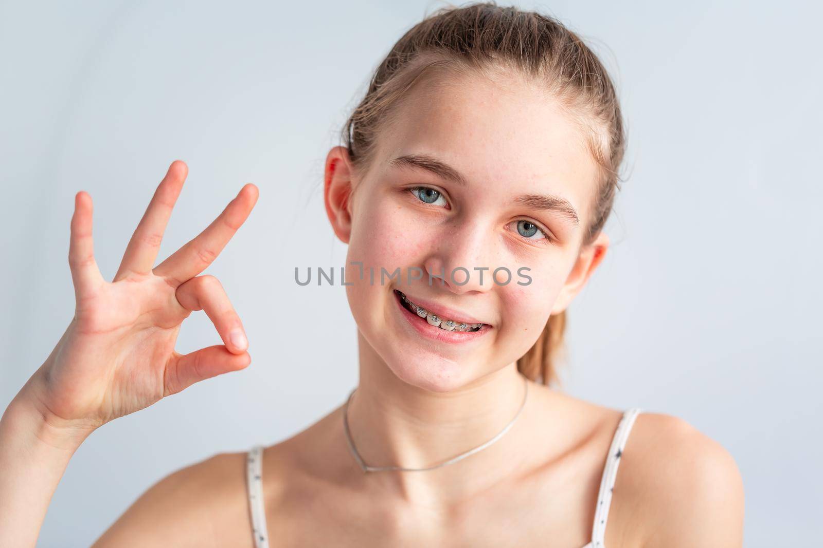 Teenage girl smiling in orthodontic brackets showing OK sign. Girl with braces on teeth. Orthodontic Treatment.