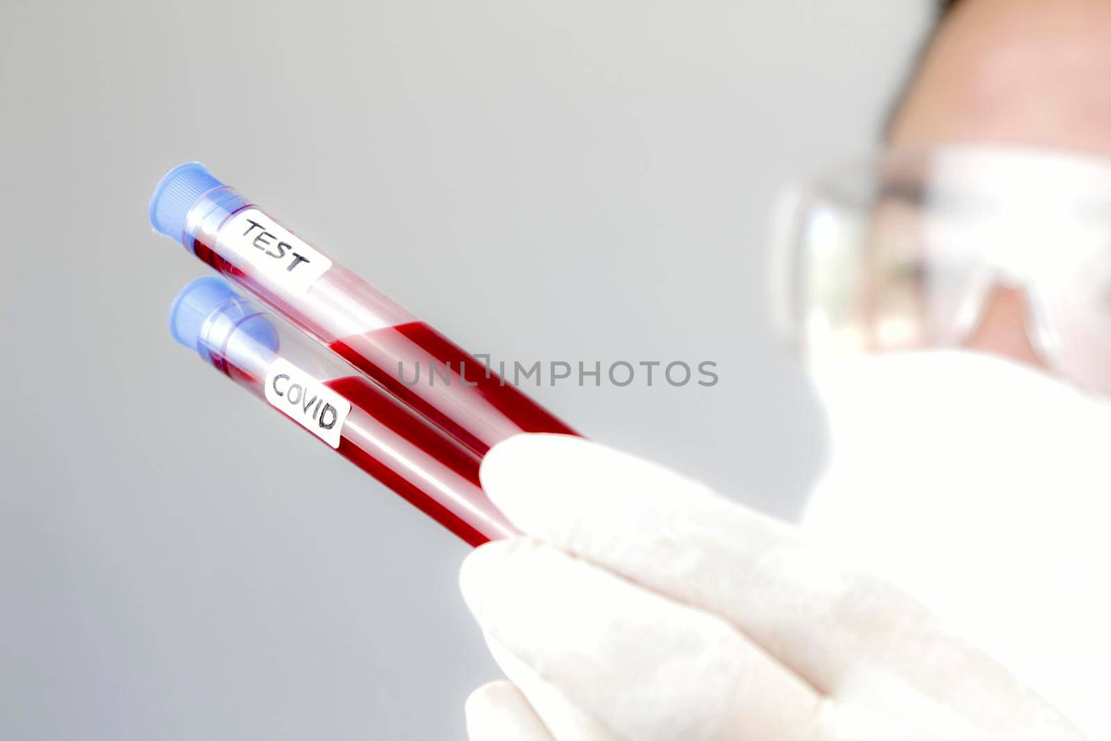 Madrid, Spain- May 2, 2020: Laboratory assistant wearing protective glasses and surgery gloves holding test tube of Covid-19 virus