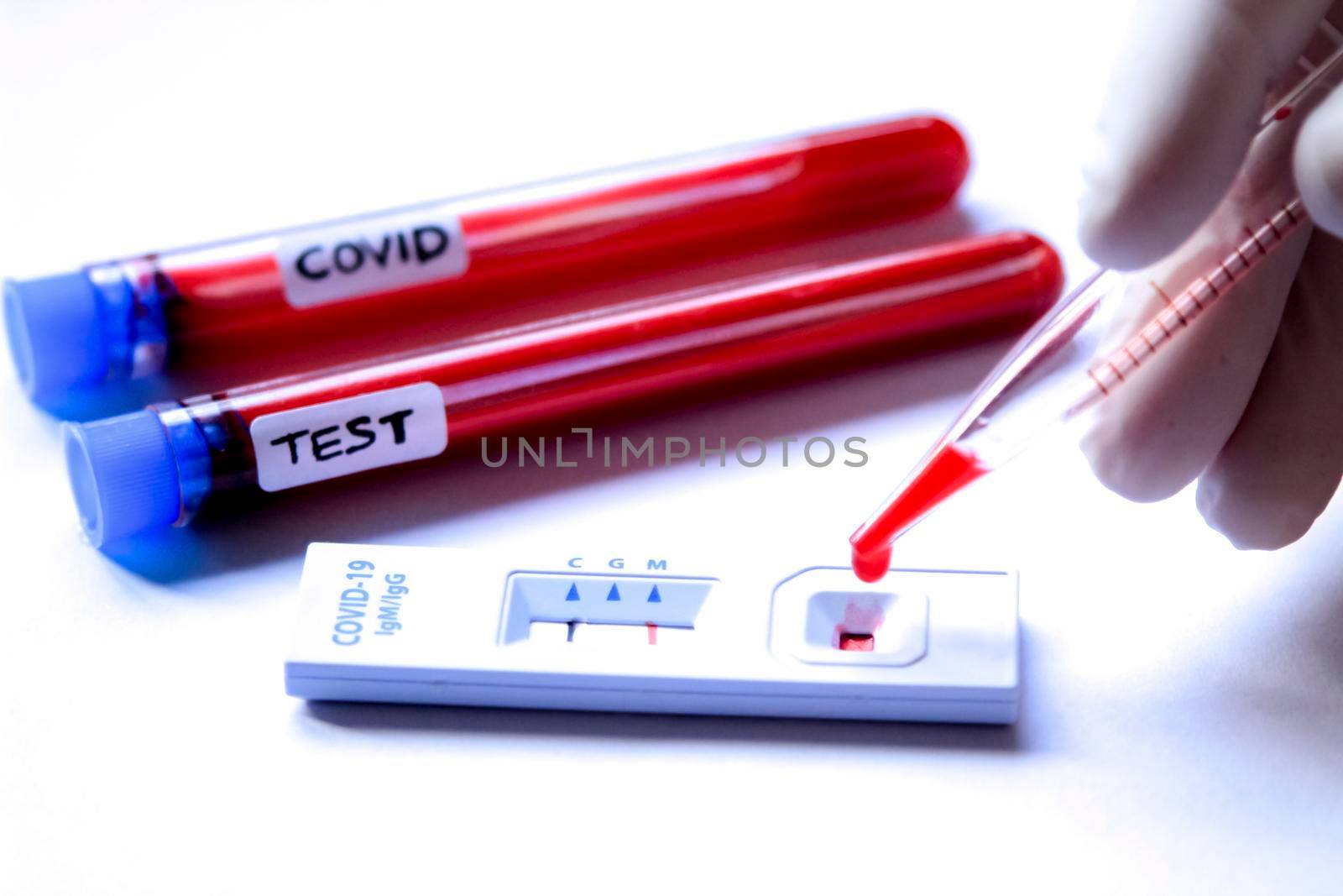 Medical worker placing blood sample on Rapid Diagnostic Test identifying antibodies for Coronavirus SARS-CoV-2 COVID-19
