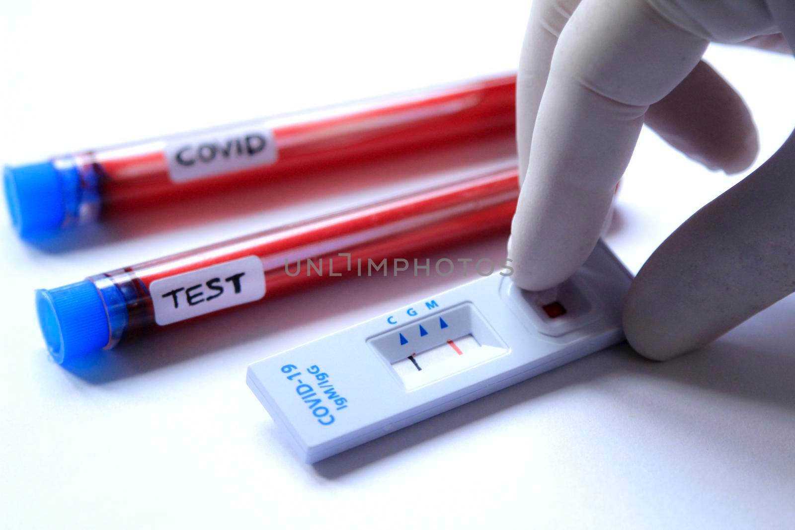 Medical worker placing blood sample on Rapid Diagnostic Test identifying antibodies for Coronavirus SARS-CoV-2 COVID-19