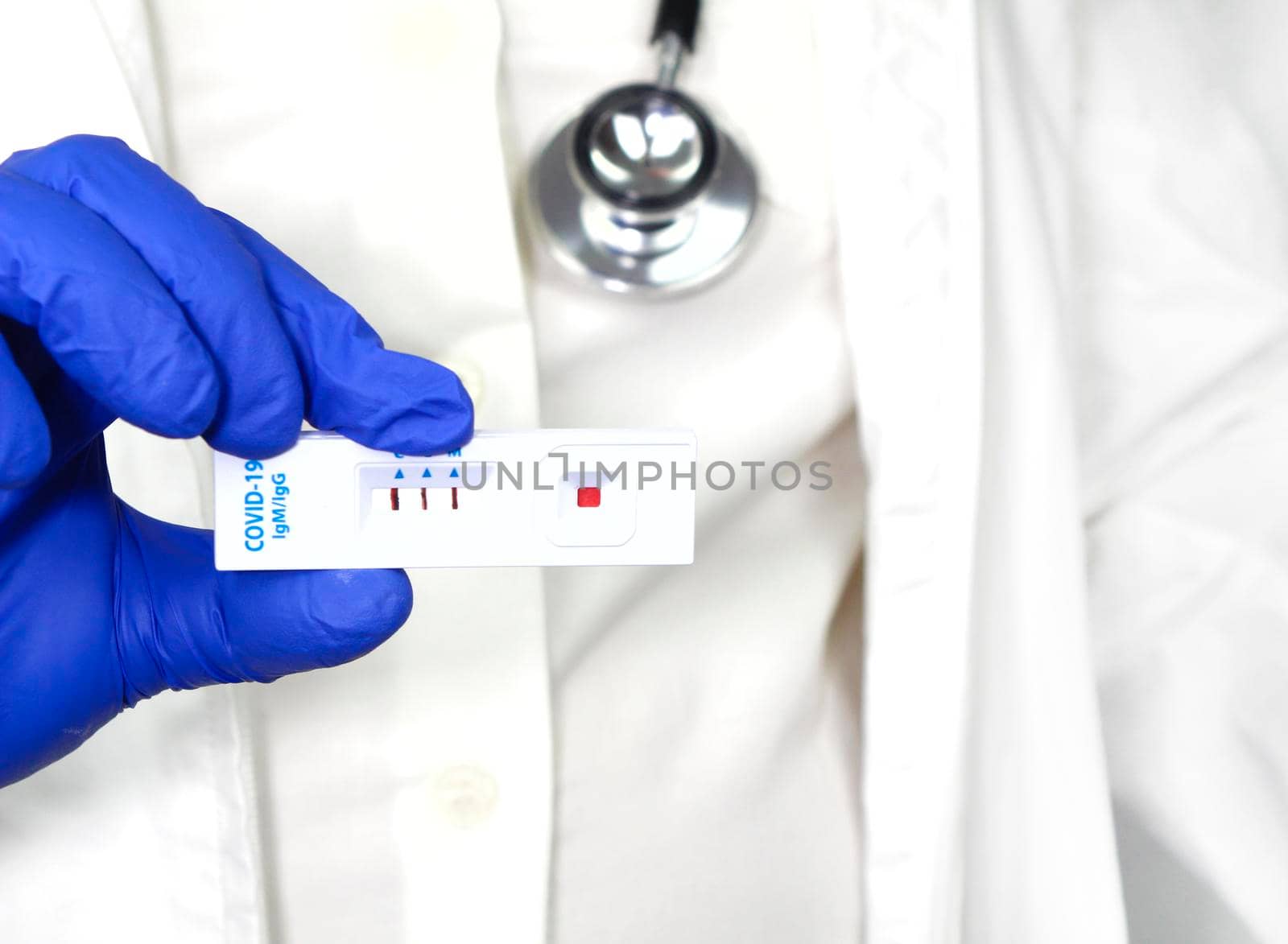 Medical worker holding positive rapid Diagnostic Test cassette identifying antibodies for Coronavirus SARS-CoV-2 COVID-19