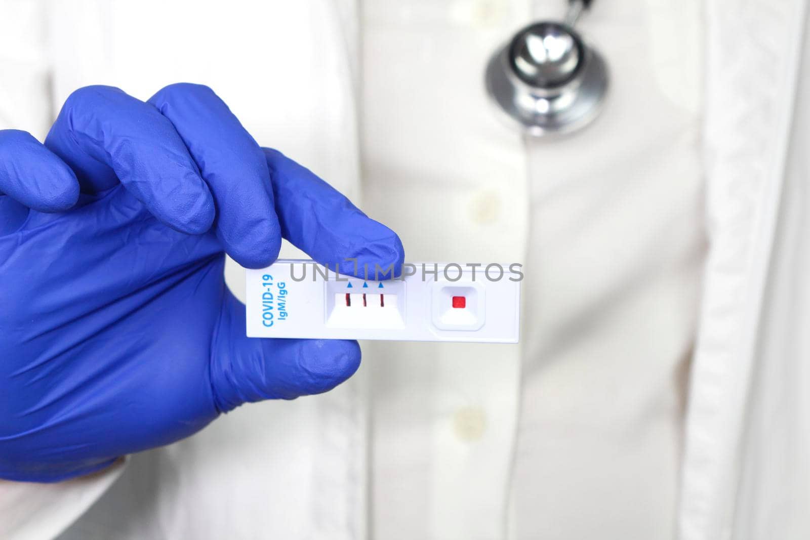 Medical worker holding positive rapid Diagnostic Test cassette identifying antibodies for Coronavirus SARS-CoV-2 COVID-19