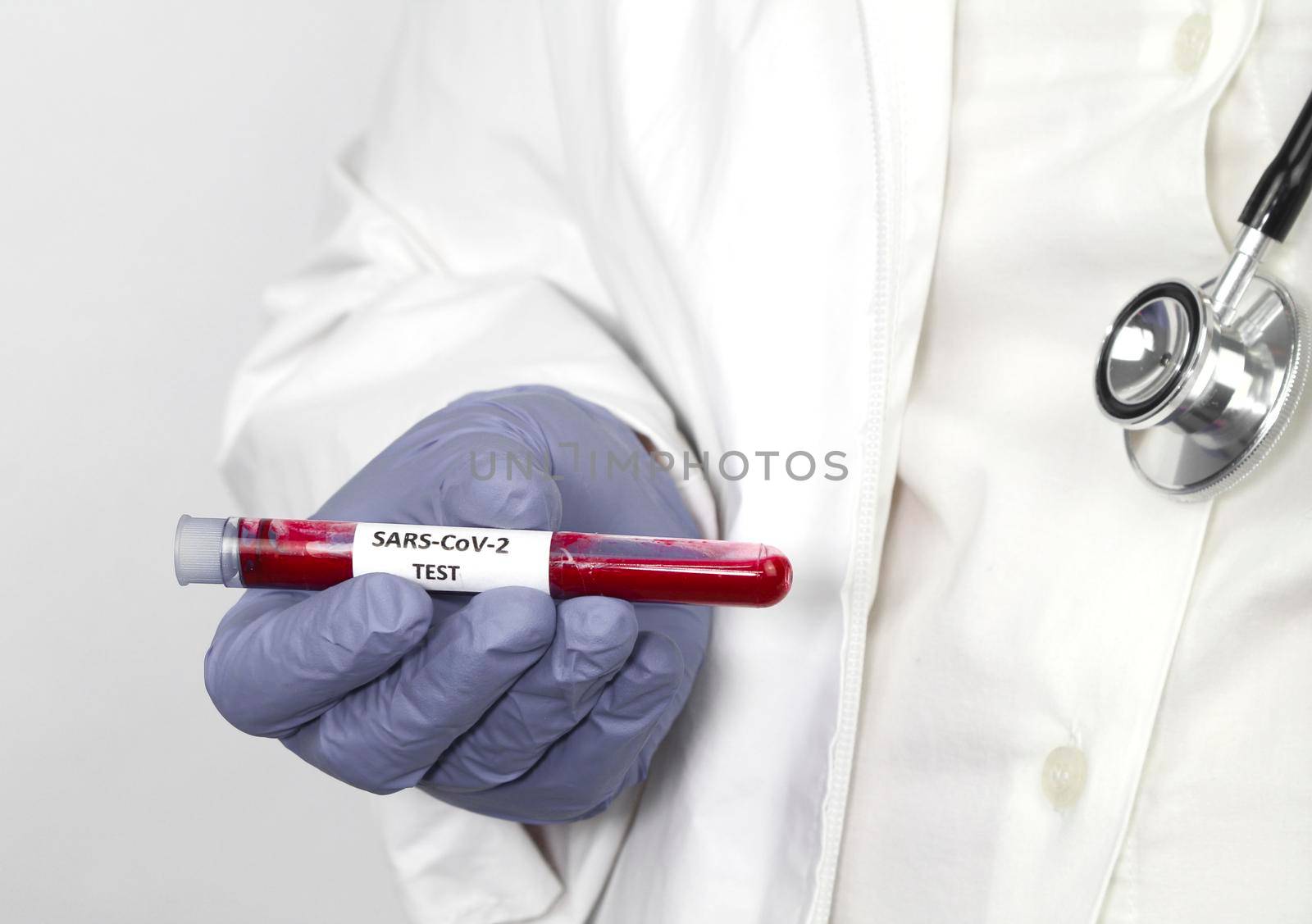 Medical worker holding test tube with blood sample for Covid-19 virus test