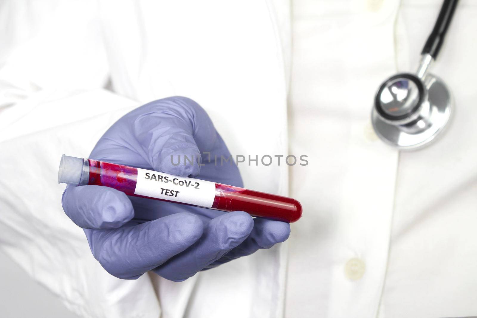 Medical worker holding test tube with blood sample for Covid-19 virus test