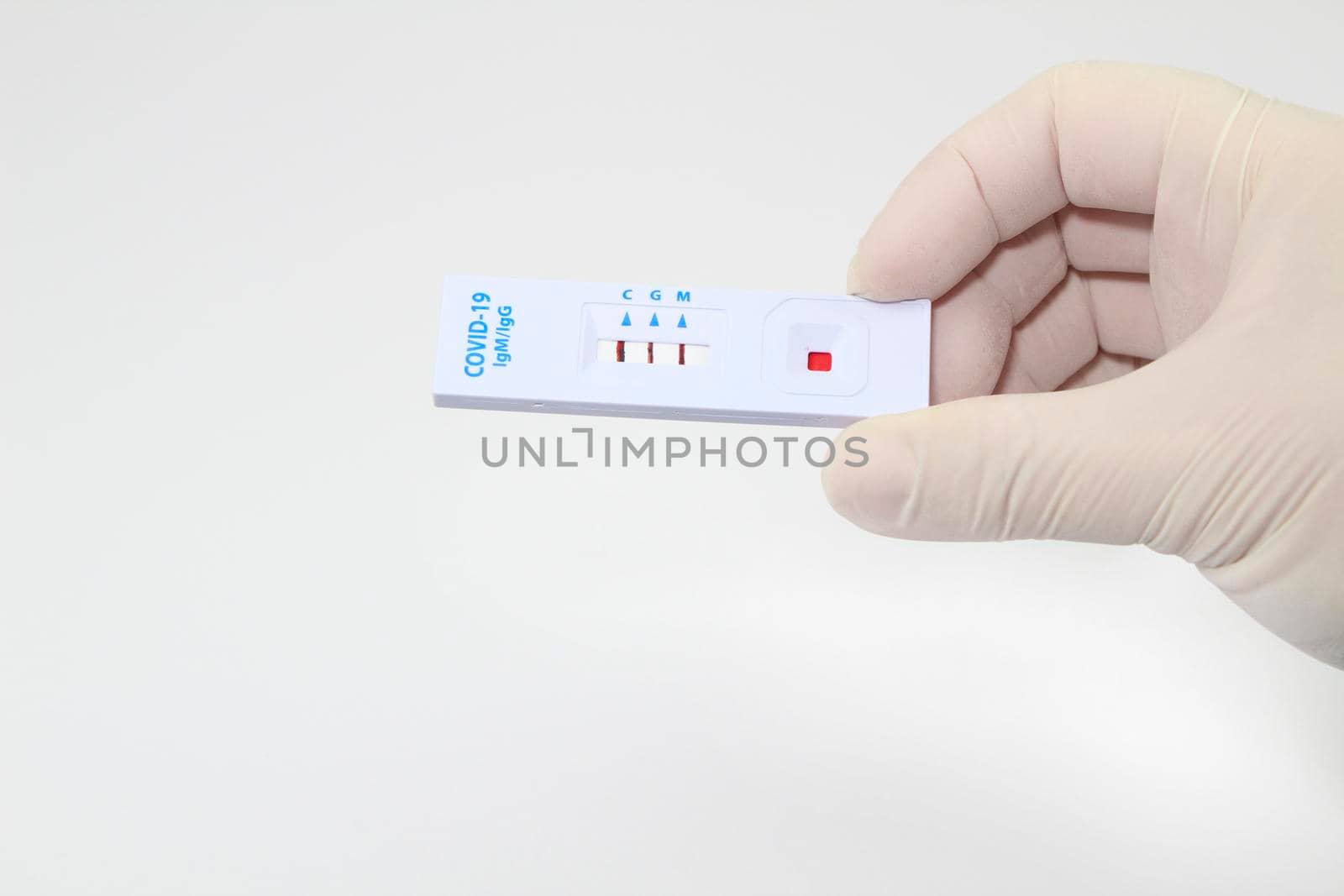 Medical worker holding positive rapid Diagnostic Test cassette identifying antibodies for Coronavirus SARS-CoV-2 COVID-19