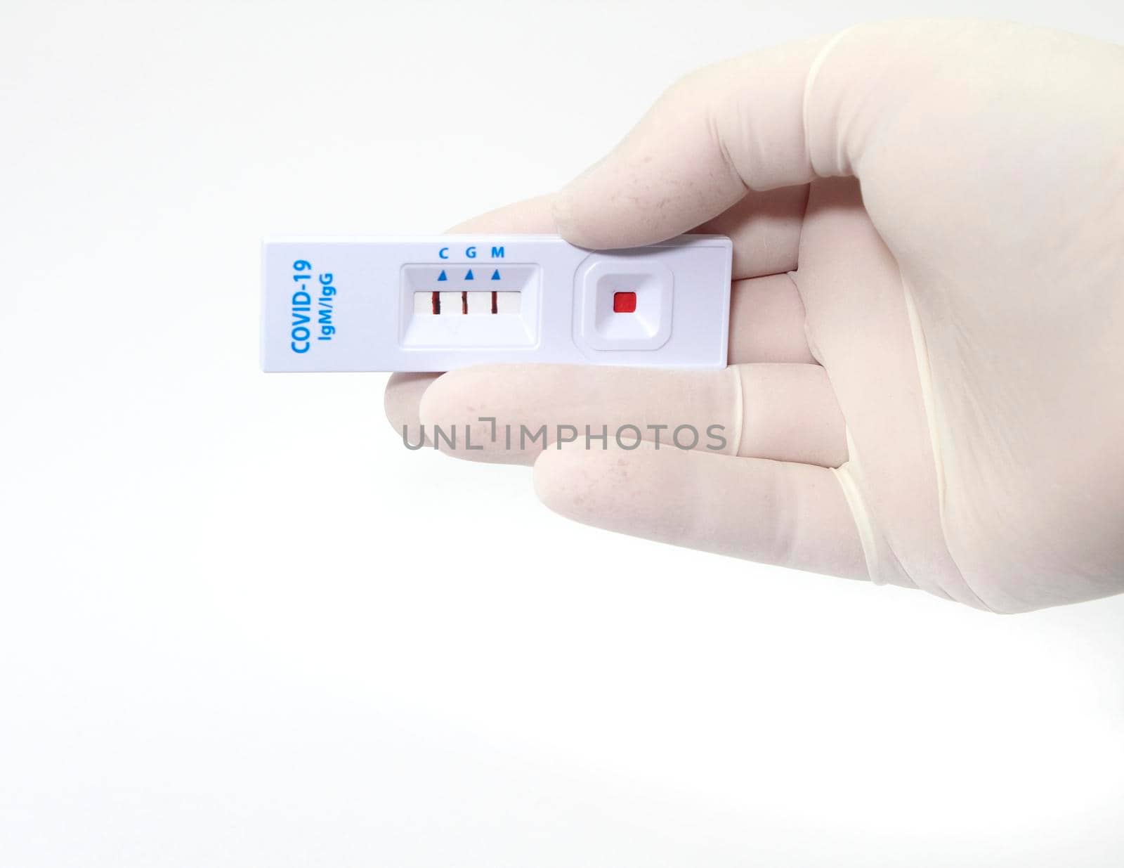 Medical worker holding positive rapid Diagnostic Test cassette identifying antibodies for Coronavirus SARS-CoV-2 COVID-19