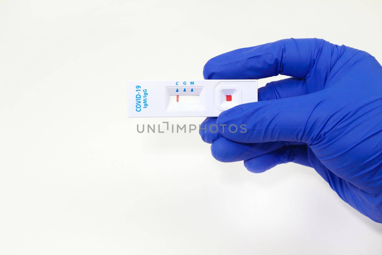 Medical worker holding negative rapid Diagnostic Test cassette identifying antibodies for Coronavirus SARS-CoV-2 COVID-19