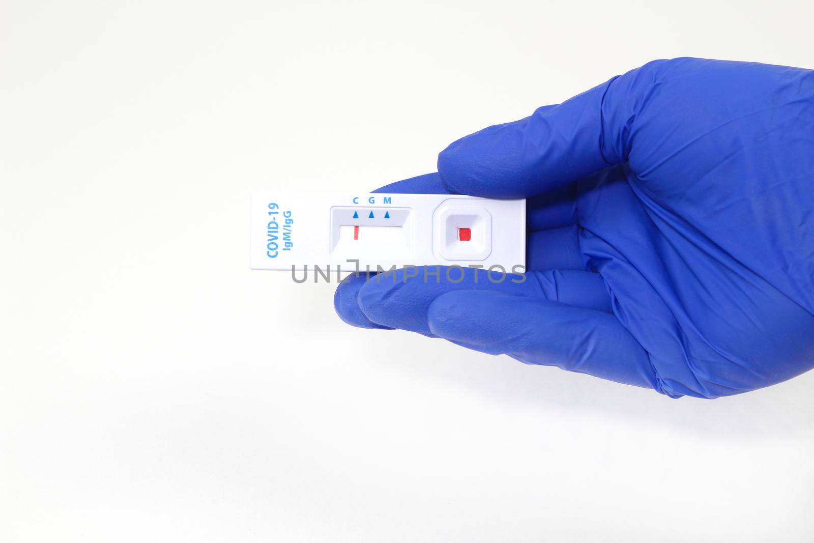 Medical worker holding negative rapid Diagnostic Test cassette identifying antibodies for Coronavirus SARS-CoV-2 COVID-19