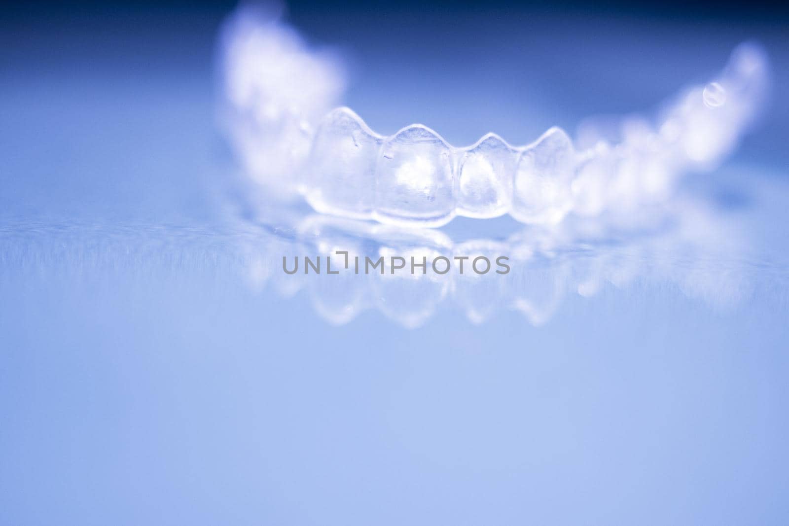 Retainer splint and transparent teeth corrector by GemaIbarra