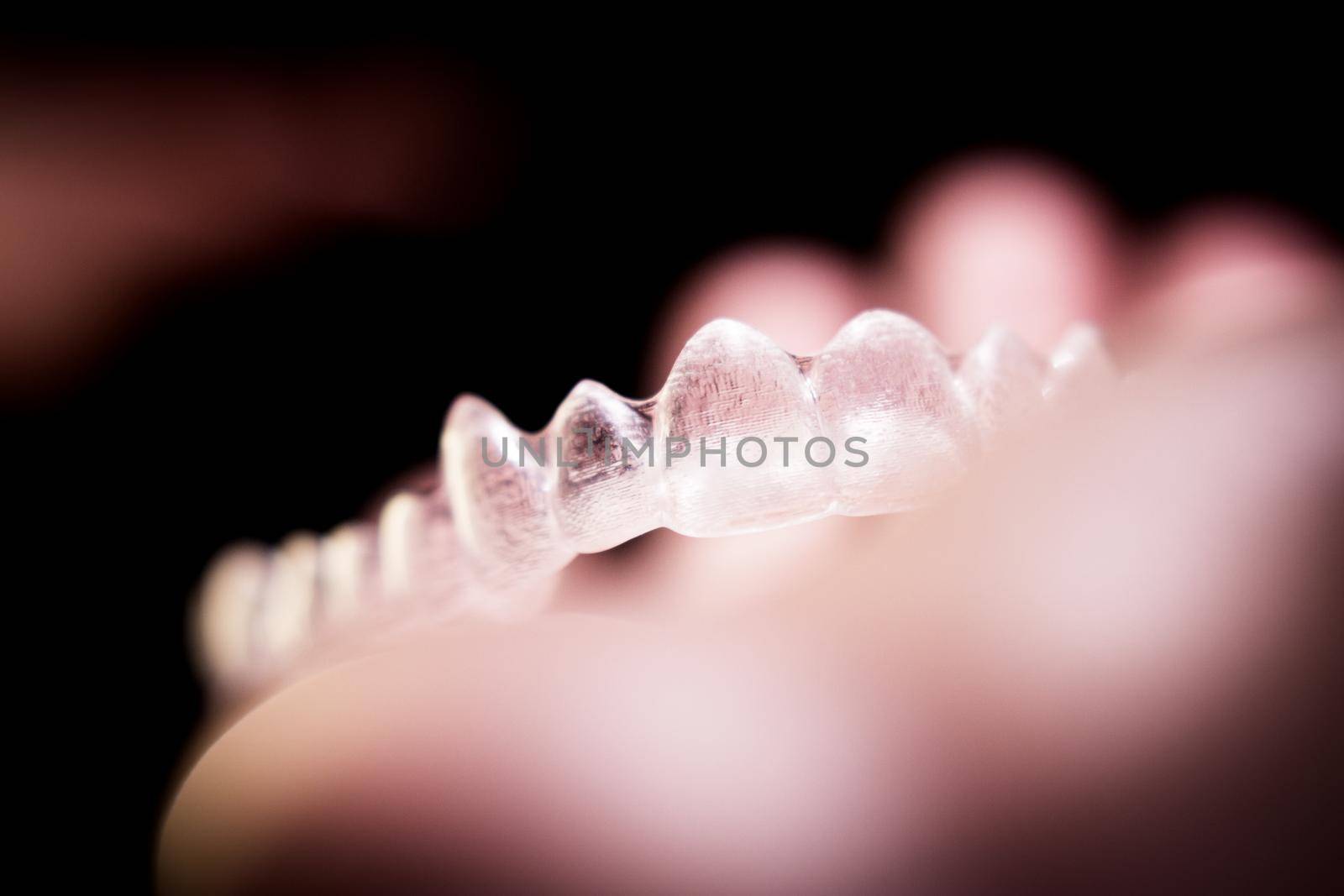 Transparent ferule retainer teeth alignment. Copy space