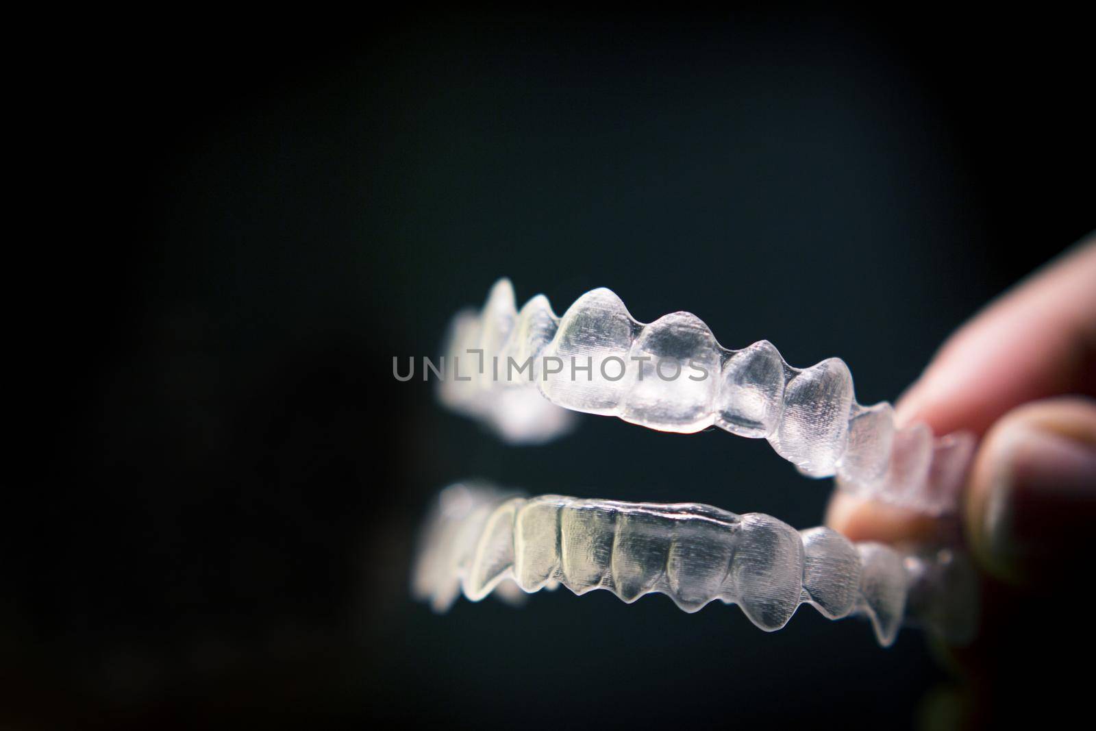 Transparent ferule retainer teeth alignment by GemaIbarra