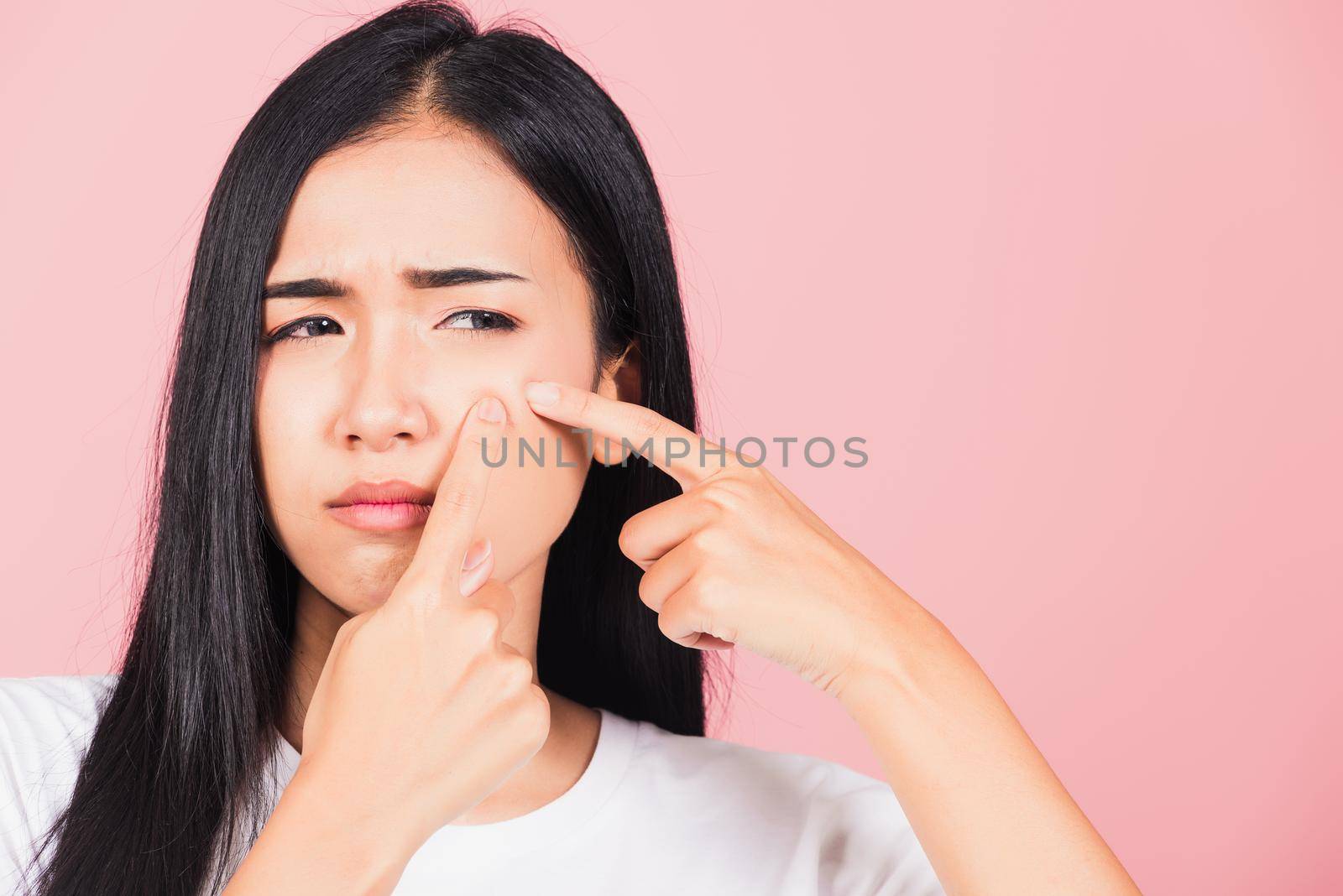 Portrait teenage Asian beautiful young woman having skin problems squeezing pimples on her face, studio shot on pink background, with copy space, Thai female acne, beauty care concept