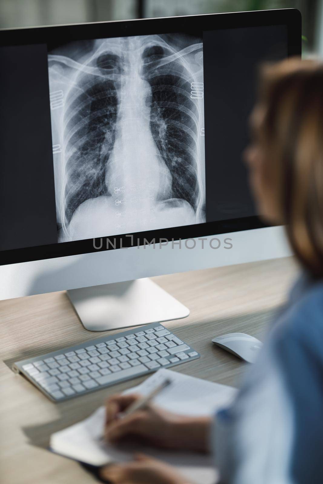 A female nurse is looking X-ray of a lungs on a computer in the hospital during coronavirus pandemic.