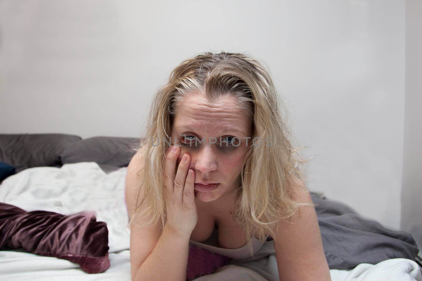  Woman looks confused and sick in bed, pulling on face with ill looking eyes