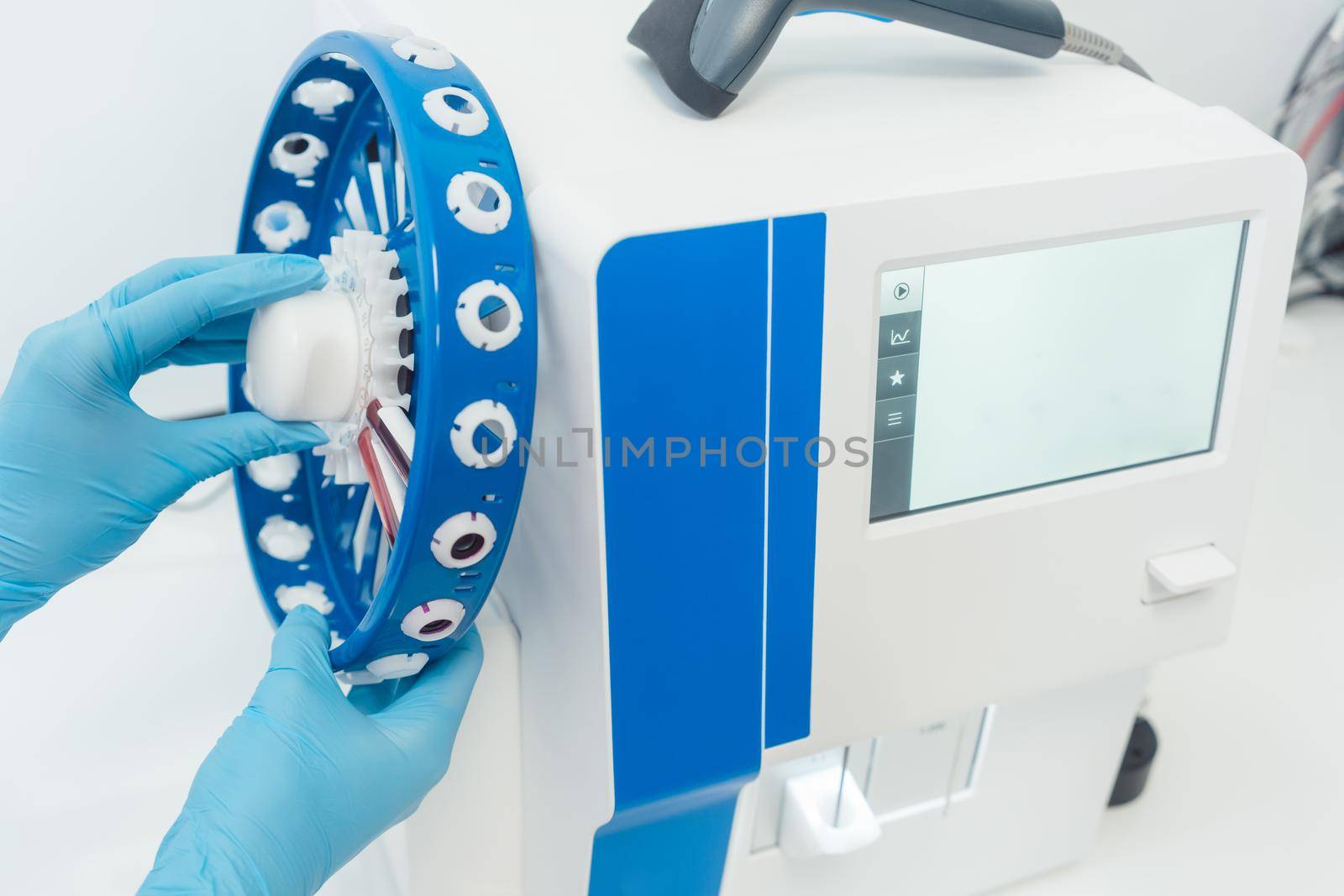 Doctor mounting blood tubes on spin wheel of centrifugal analyzer