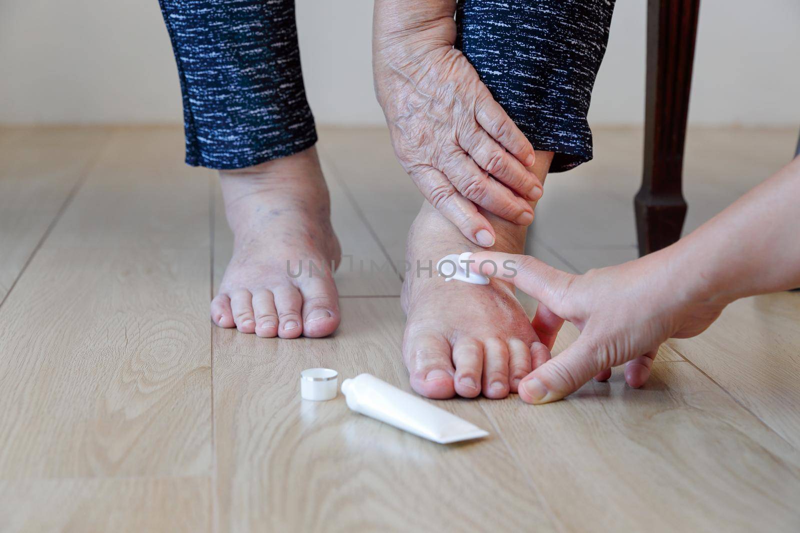 Elderly woman putting cream on swollen feet by caregiver
