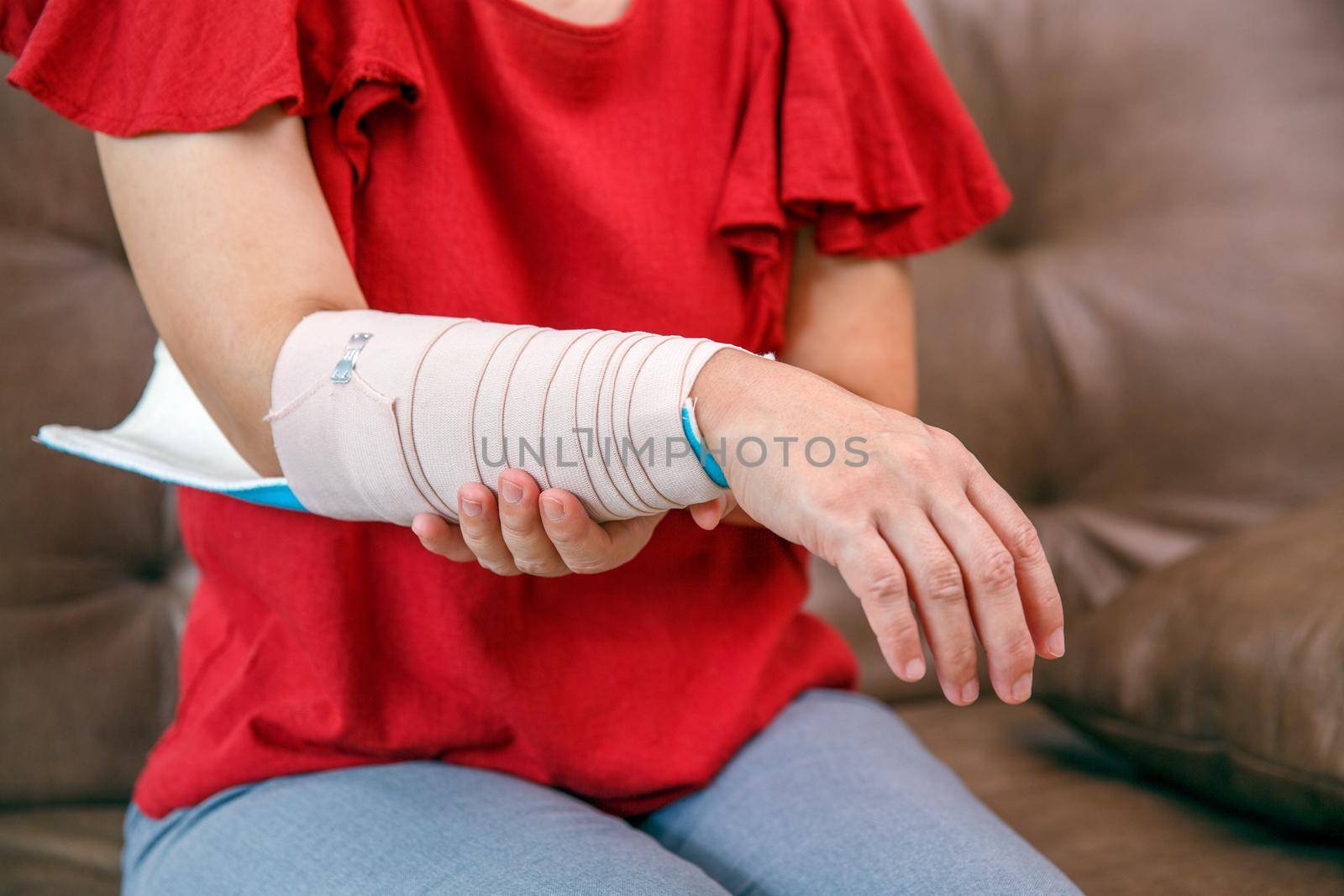 Osteoporosis splint with an elastic bandage is applied to help keep the splint in place by toa55