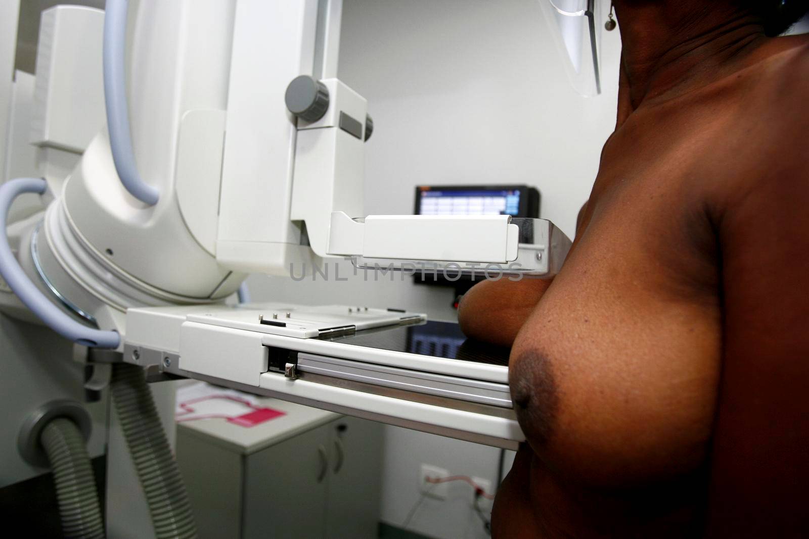 salvador, bahia / brazil - october 22, 2014: woman is seen during mammography exam to detect breast cancer in the city of Salvador.