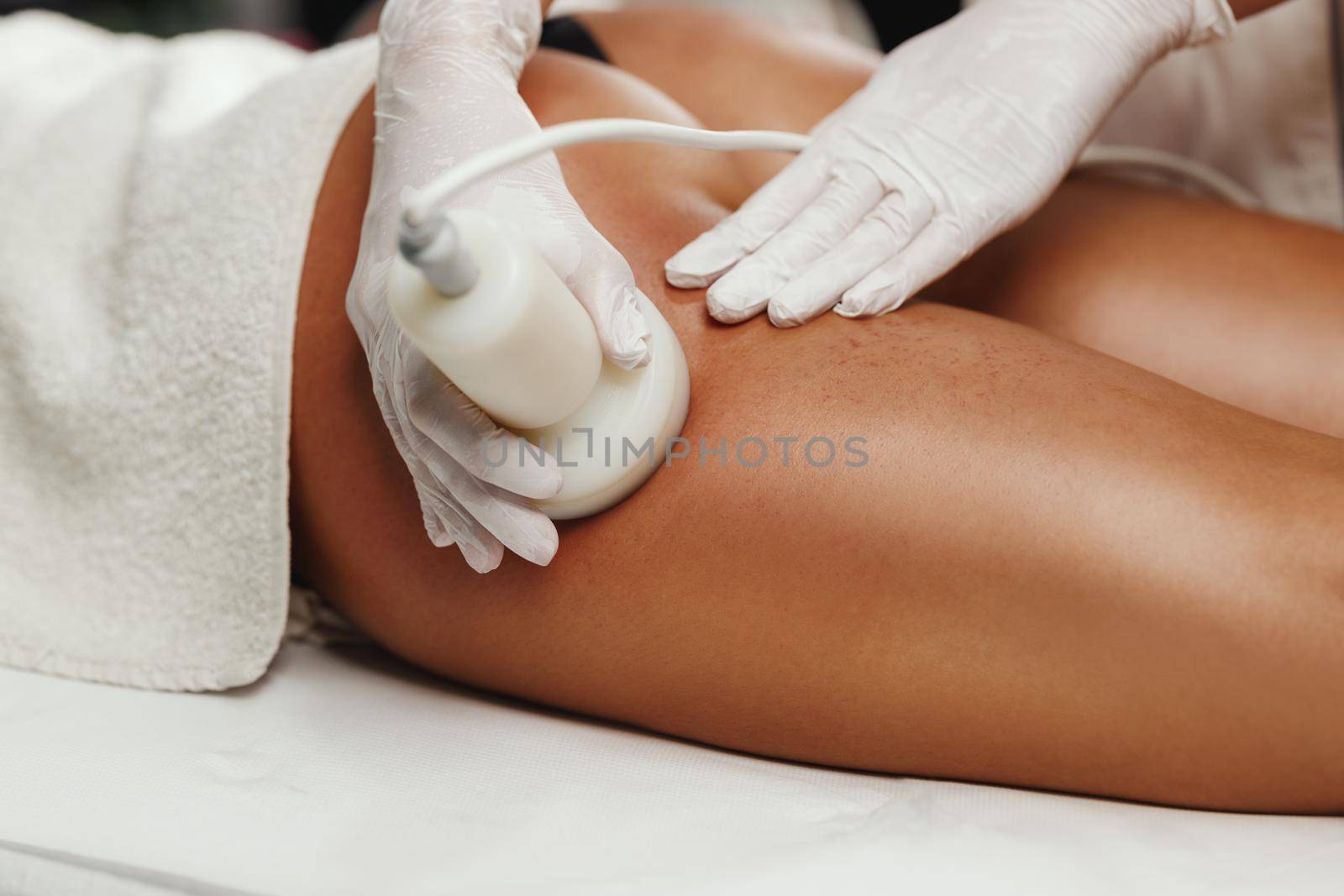 Shot of an unrecognizable woman getting anti cellulite massage at the beauty salon. She have an ultrasound cavitacion treatment to fat reduction.