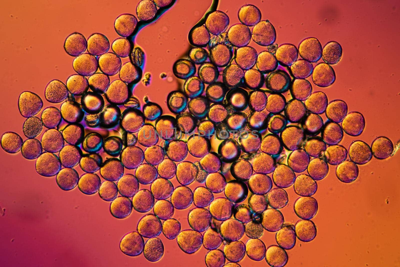 Apple pollen from a blossom in spring under the microscope
