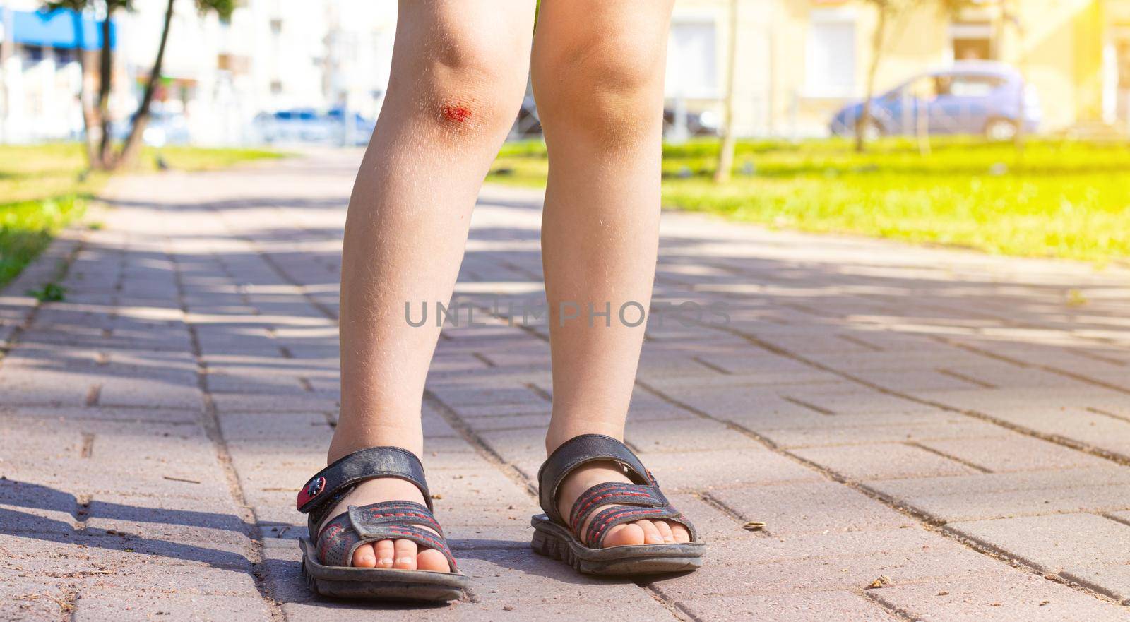 The wound on the child's leg . Fell on the road. Broken knee. Health. Article about the fall of a child. Article about the treatment of wounds. Bad leg . The child fell and broke his knee . blood