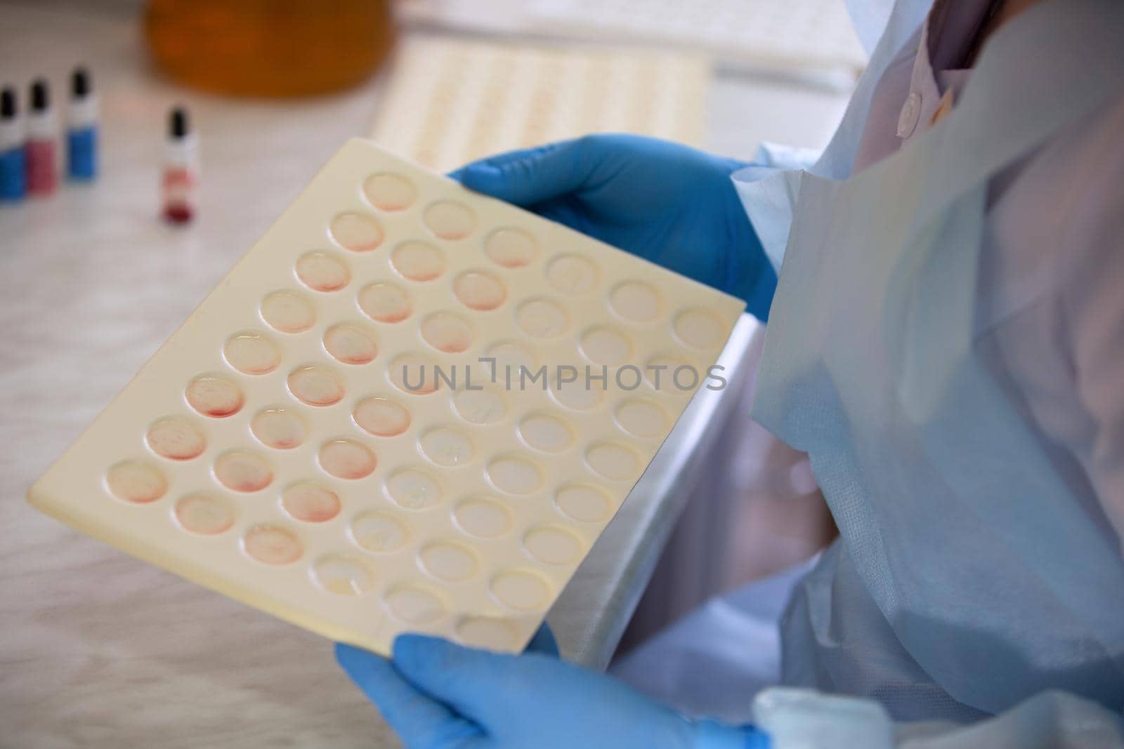 Blood test.Blood type examination