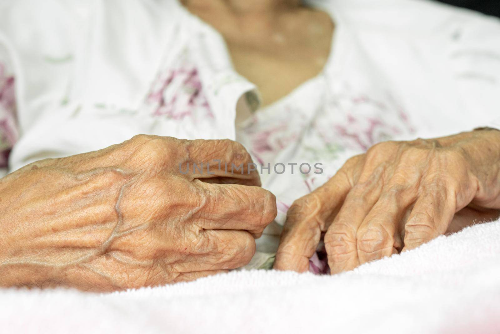 Elderly woman fasten buttons on dress , progressive brain disorder ,Close up hand