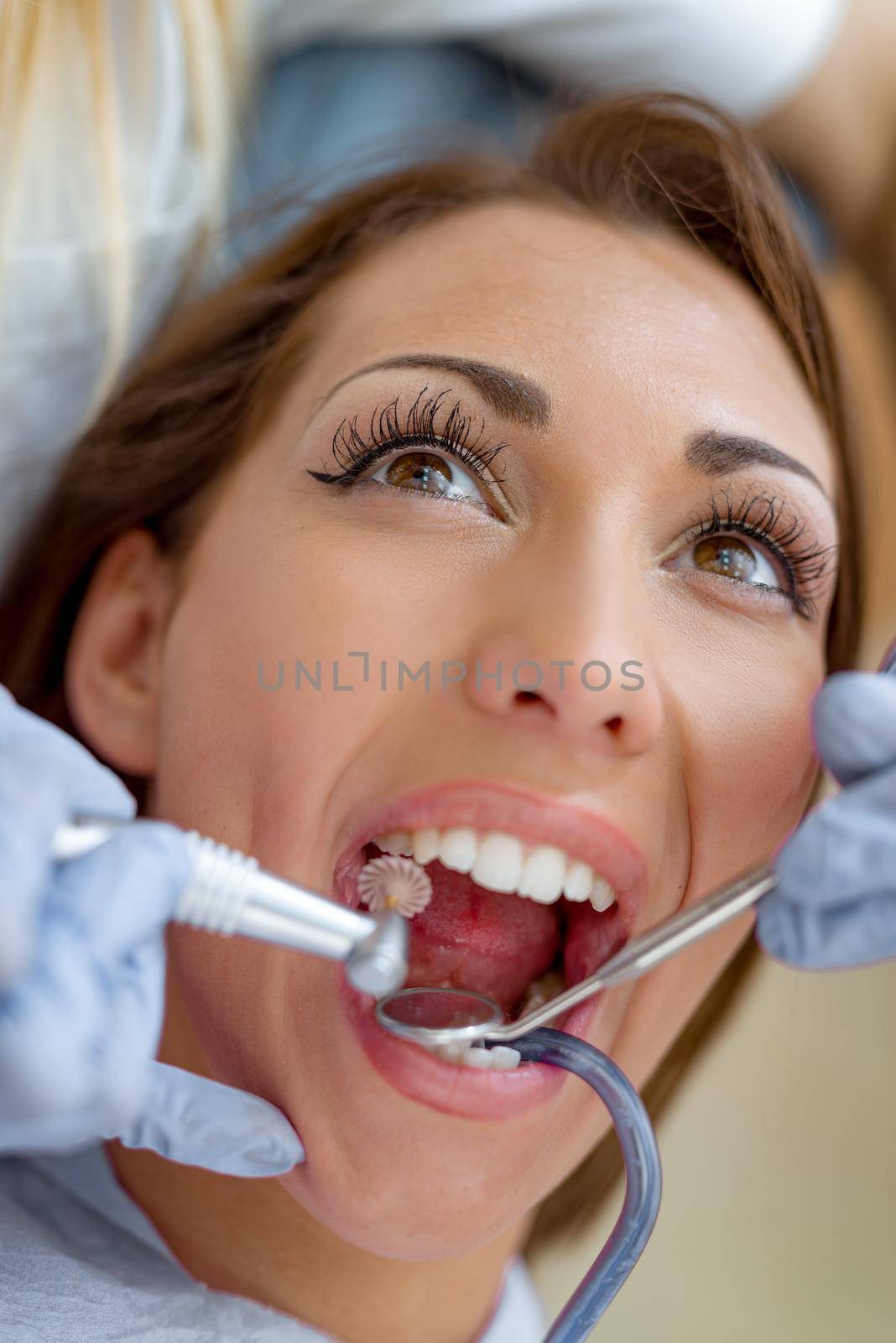 Close- up of beautiful young woman in visit at the dentist office and dentist repair her teeth. 