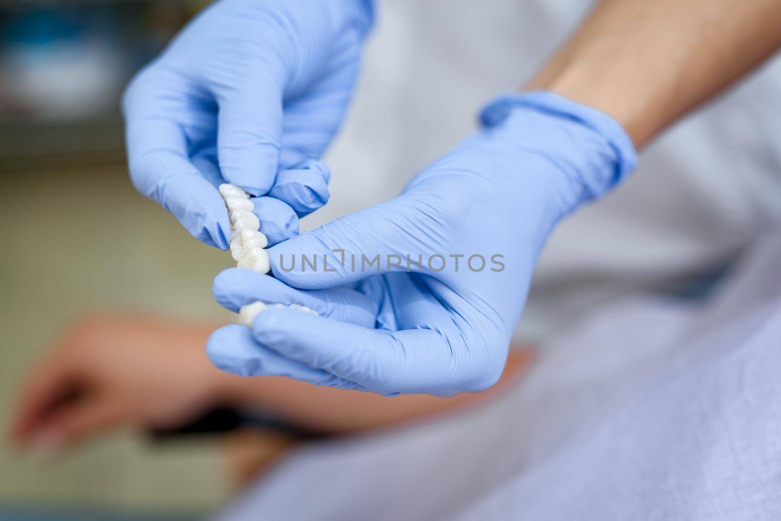 Dentist showing porcelain crowns to the patient. Close-up. Unrecognizable people. Selective focus. Focus on ceramics implant.