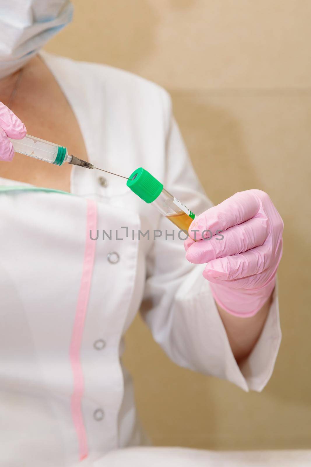 The specialist draws out the blood plasma from the test tube using a syringe. Plasmolifting, medical cosmetology