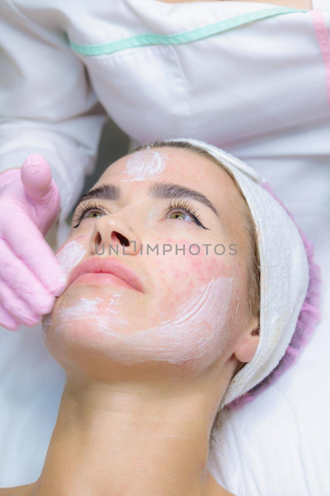 A young woman is wiped off traces of blood from a plasma injection on her face. Plasmolifting. Apply cream.