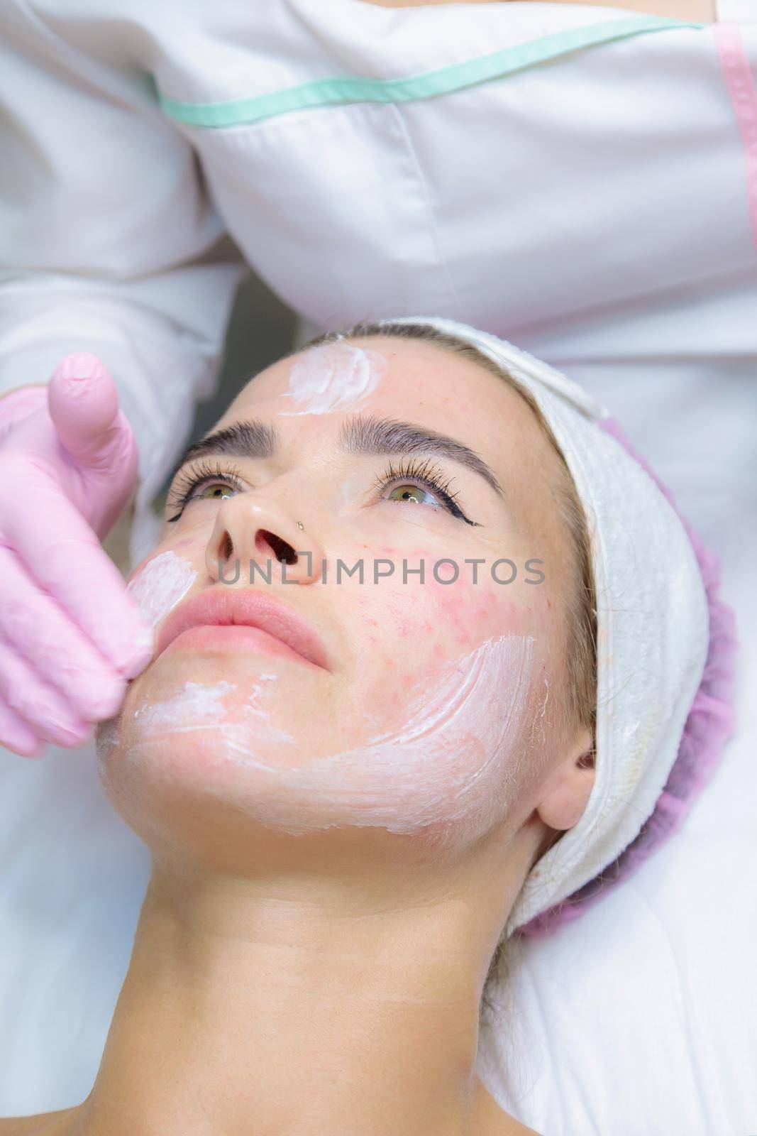A young woman is wiped off traces of blood from a plasma injection on her face. Plasmolifting. Apply cream.