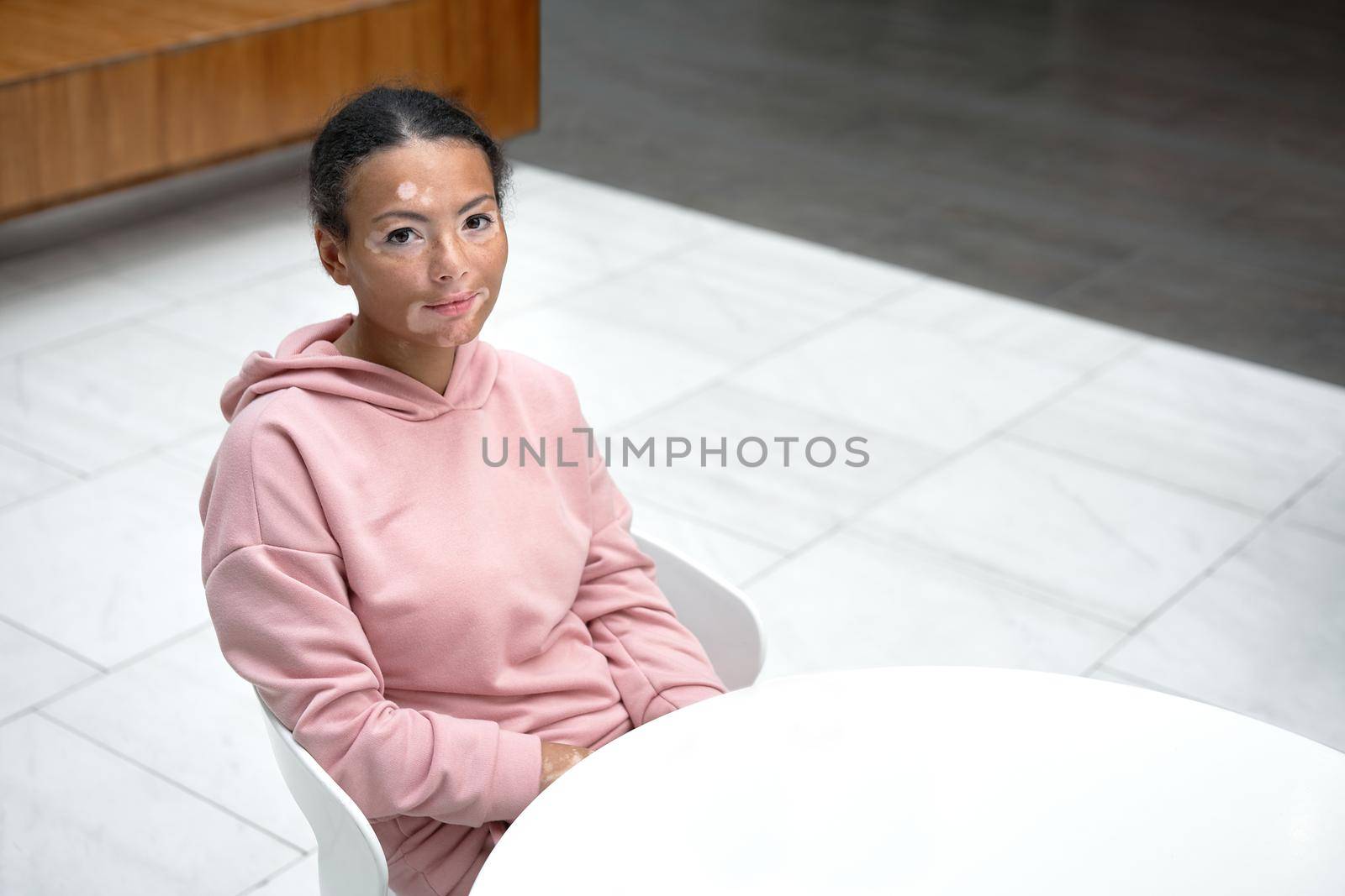 Black african american woman with vitiligo pigmentation skin problem indoor dressed pink hoodie sitting table high angle view with copy space for text