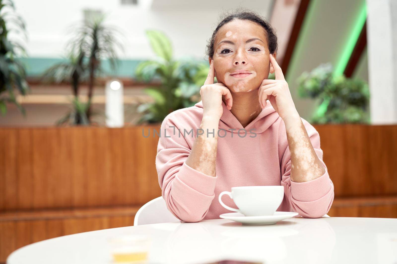 Black african american woman with vitiligo pigmentation skin problem indoor dressed pink hoodie put on a hood close up portrait with hand near face