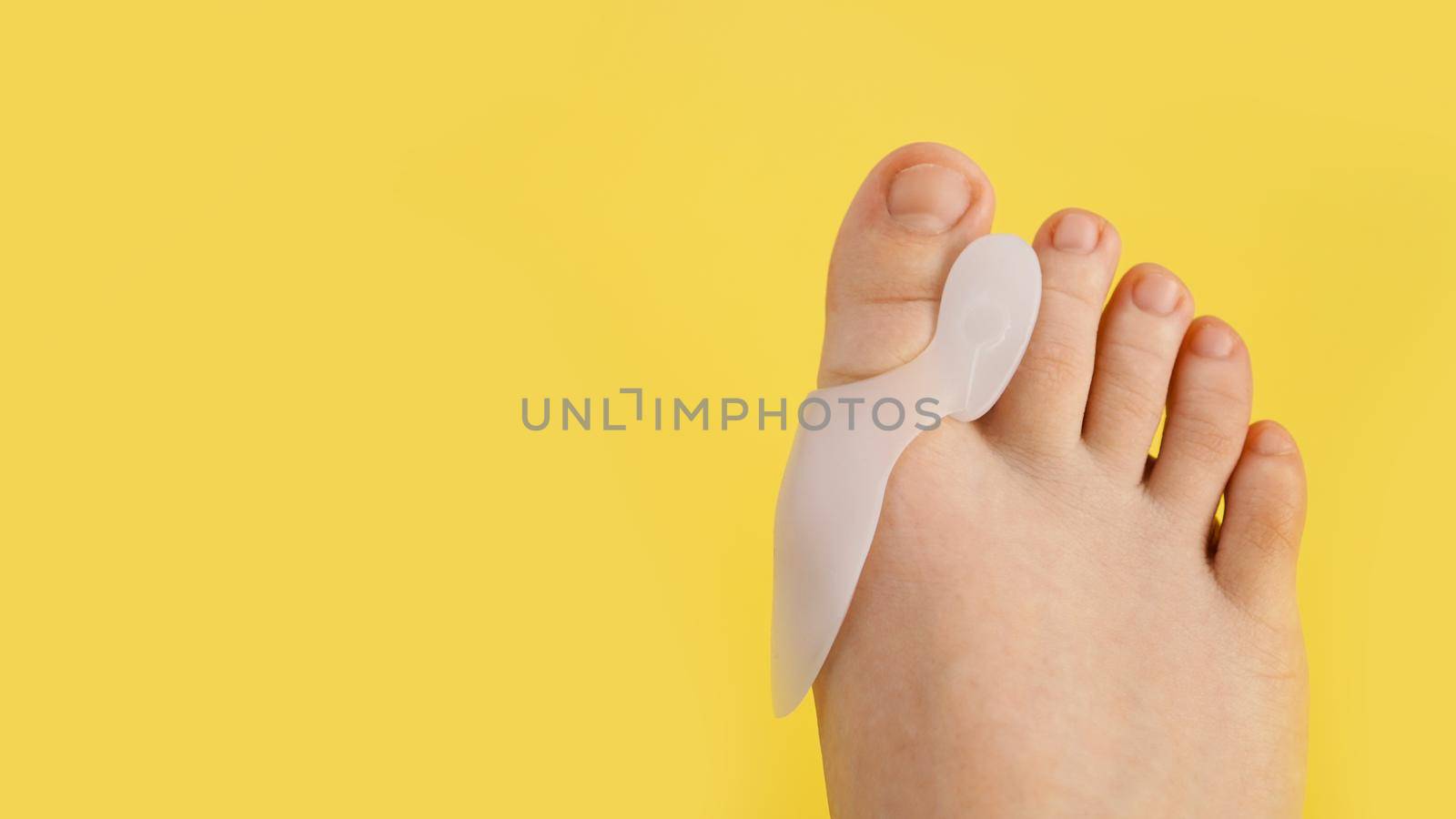 Silicone finger separator. Orthopedic thumb corrector. Legs on a bright yellow background.