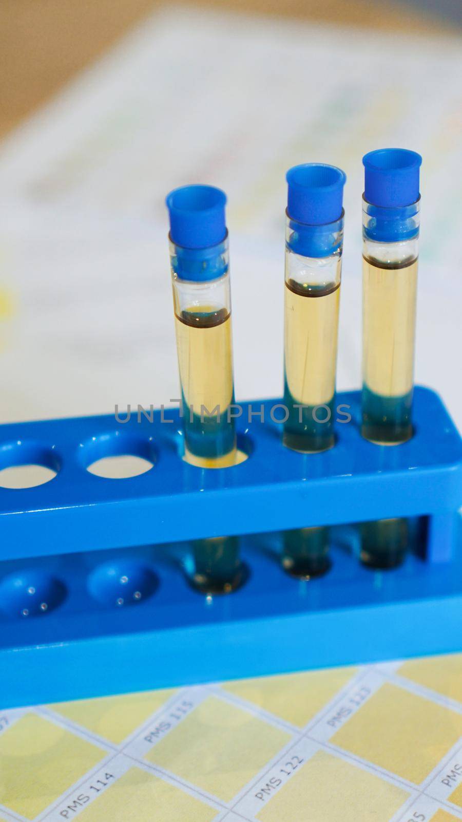 Test tubes with urine on medical color schemes. The concept of laboratory analyzes, ph control. Vertical photo