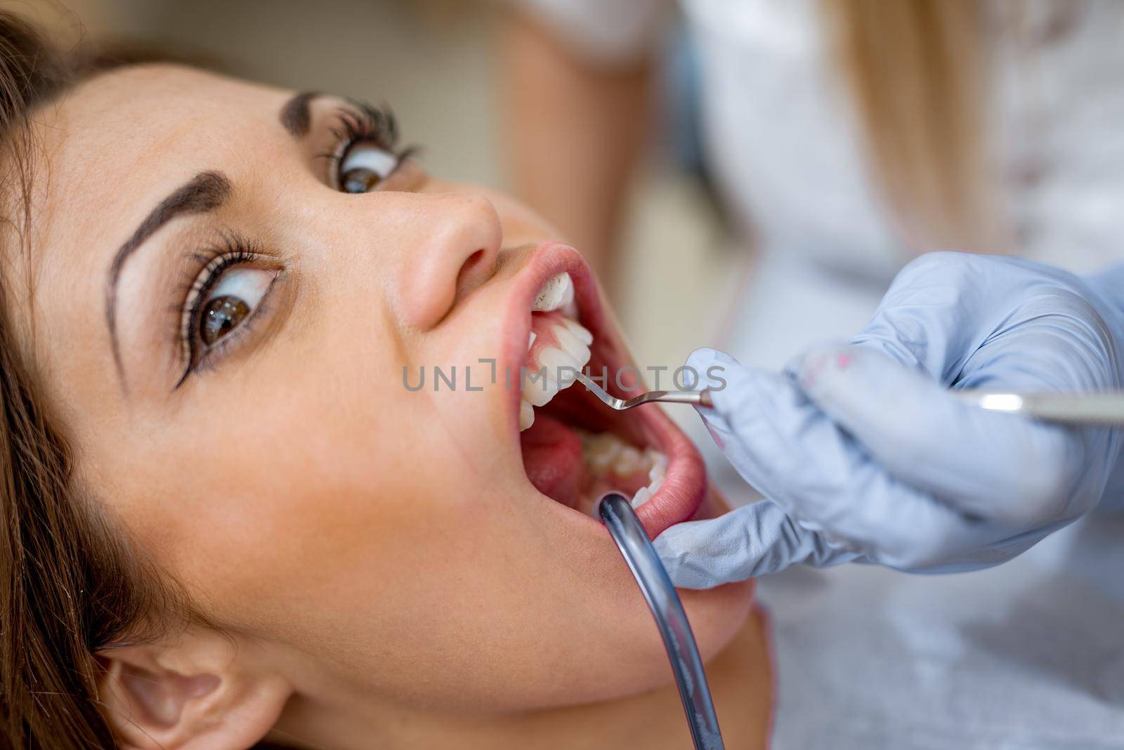 Close-up of beautiful young woman in visit at the dentist office and dentist repair her teeth. 