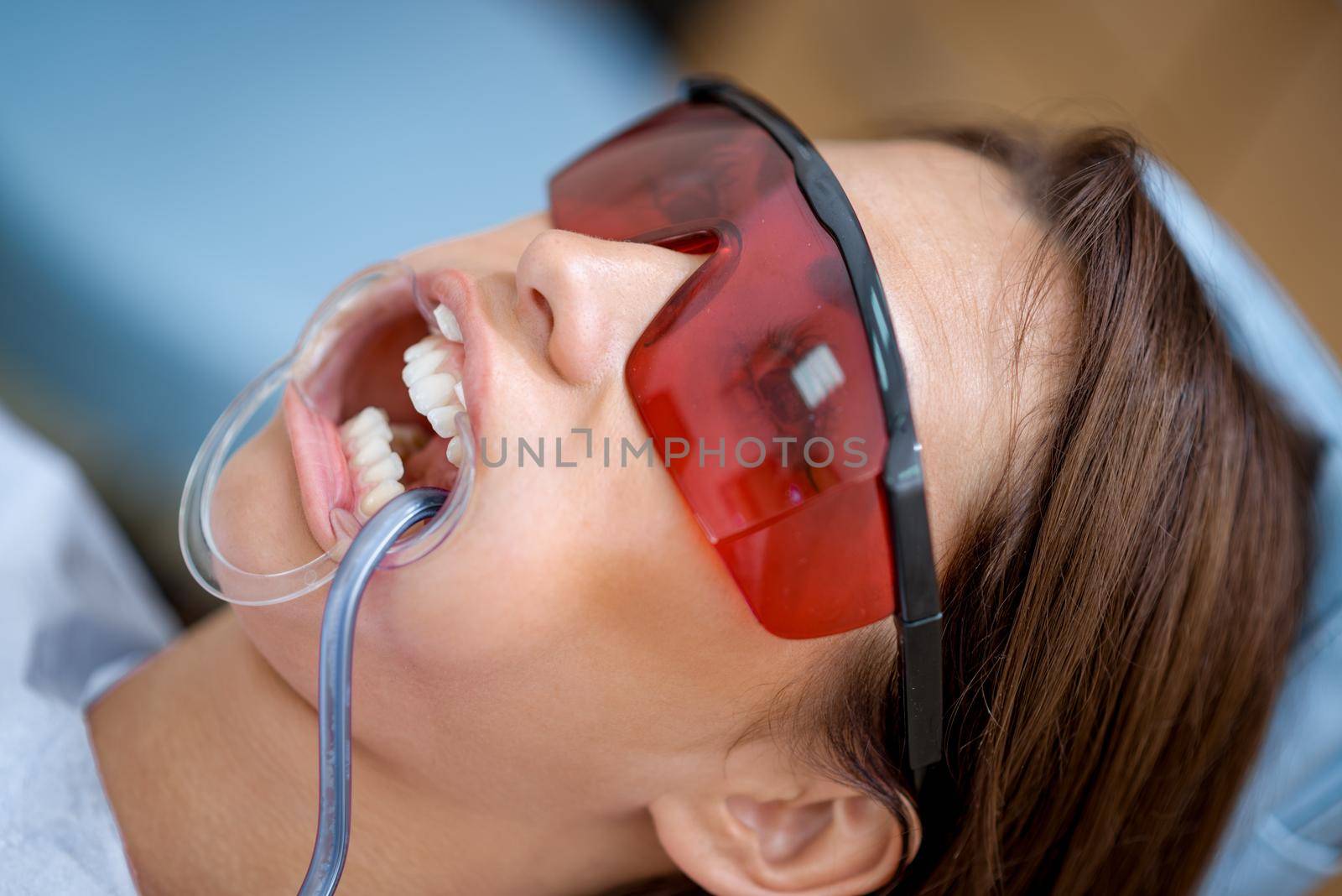 Close-up of beautiful young woman in visit at the dentist office preparing for laser whitening teeth. 