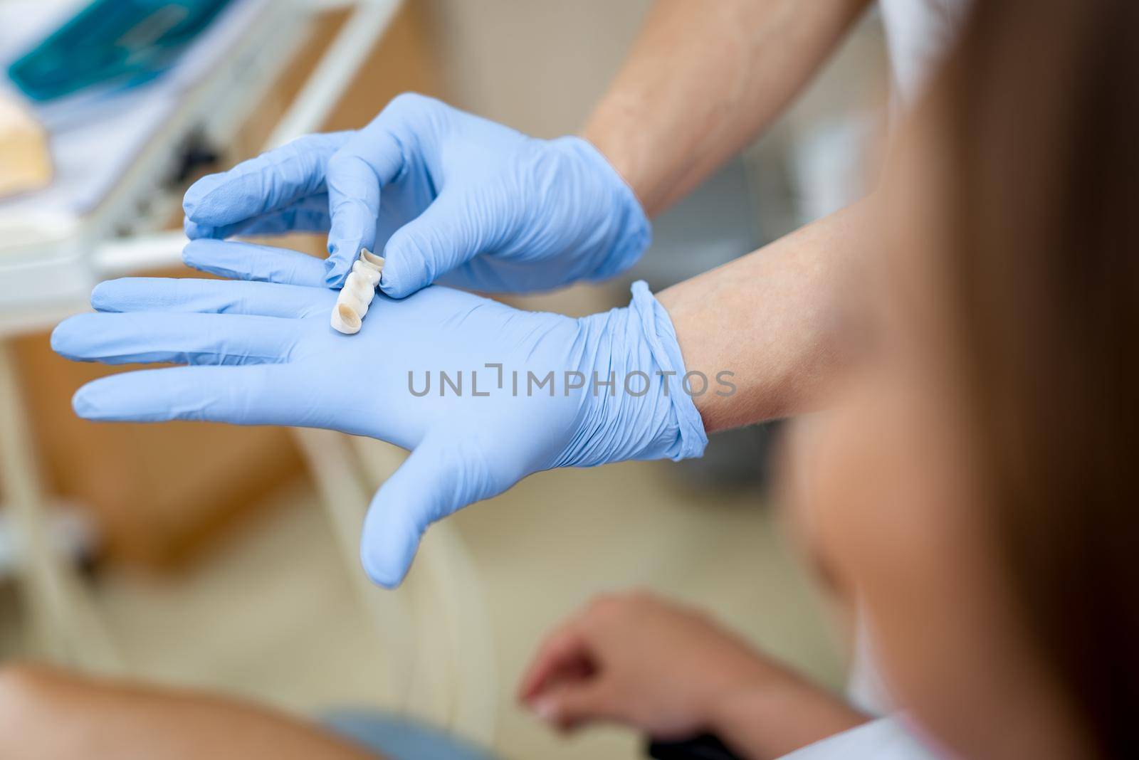 Dentist showing porcelain crowns to the patient. Close-up. Unrecognizable people.