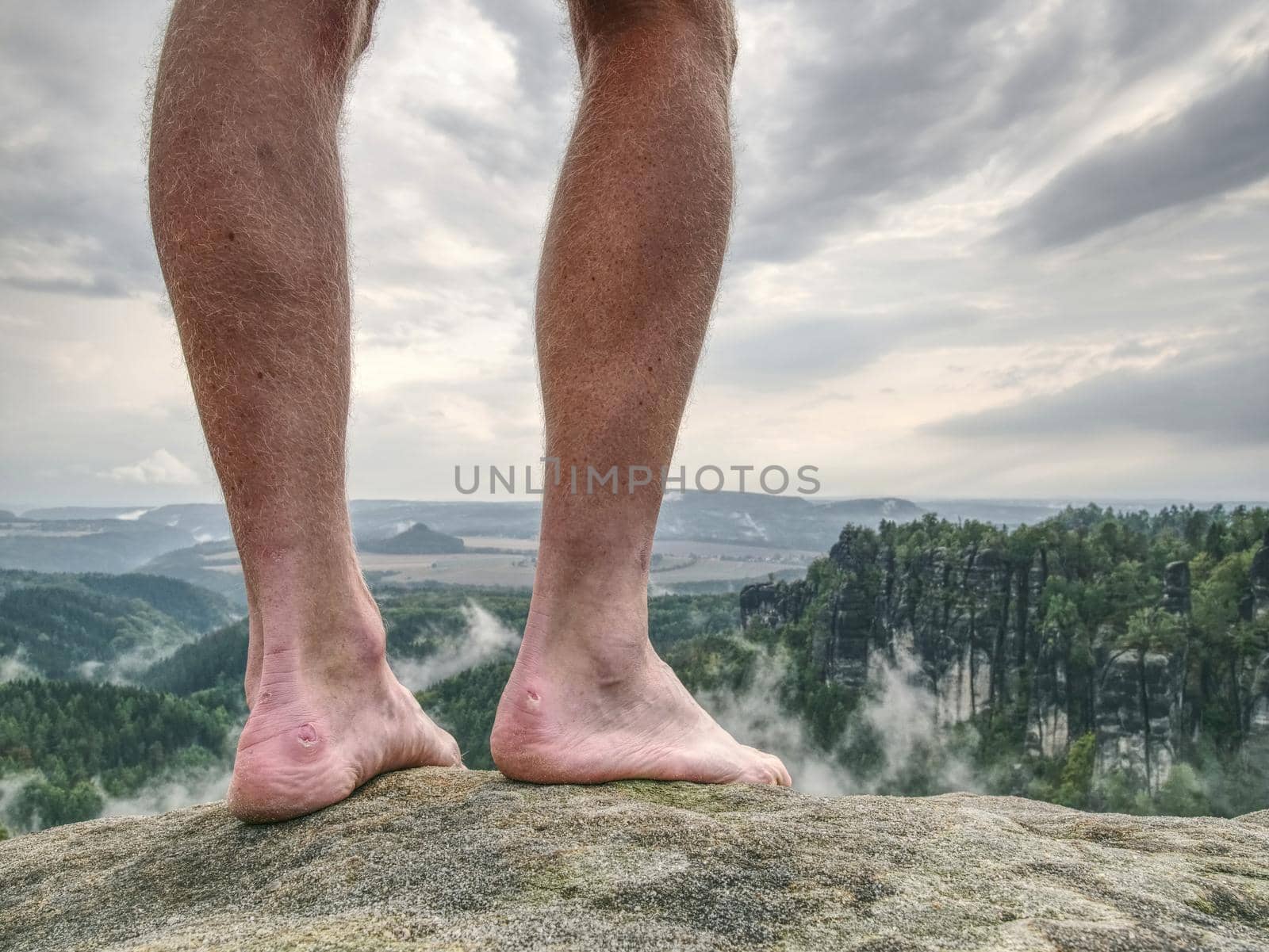 Naked male legs on peak. Sandstone rock with tired hikers legs without shoes. Misty morning climbing.  Outdoor activities.